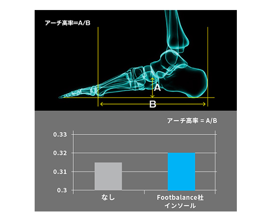 アーチ高率の変化