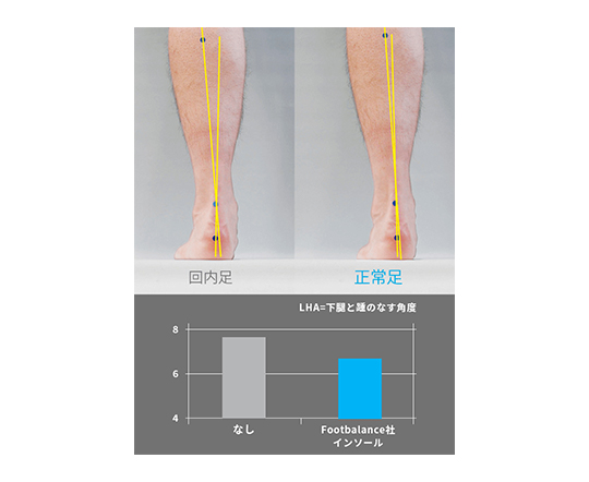 足部アライメントの評価