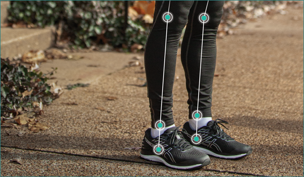 施術効果を“足元から”支え、再発予防や効果の持続に貢献