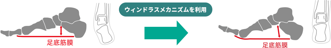 ウィンドラスメカニズムの利用